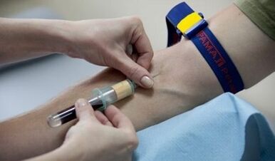 Cómo prepararse para la prueba de parásitos
