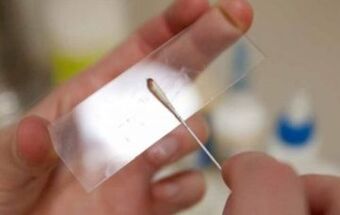 Qué pruebas deben tomarse para los parásitos