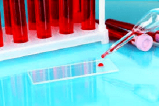 Examen de sangre
