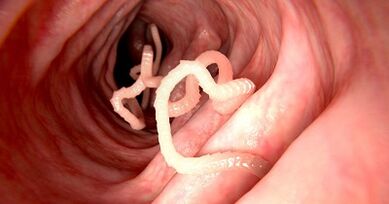 Las causas de los parásitos en el cuerpo humano