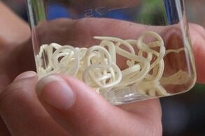 parásitos del cuerpo humano