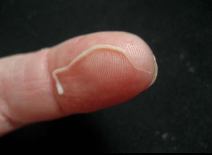 parásito lombriz intestinal del cuerpo humano